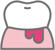 出血