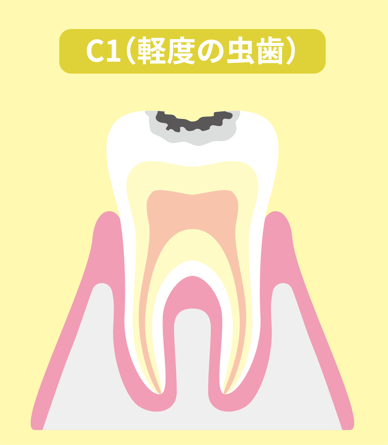 C1