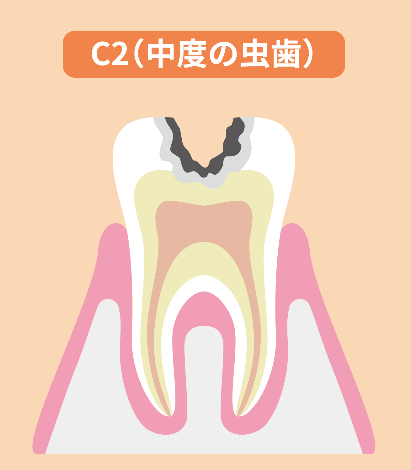 C2