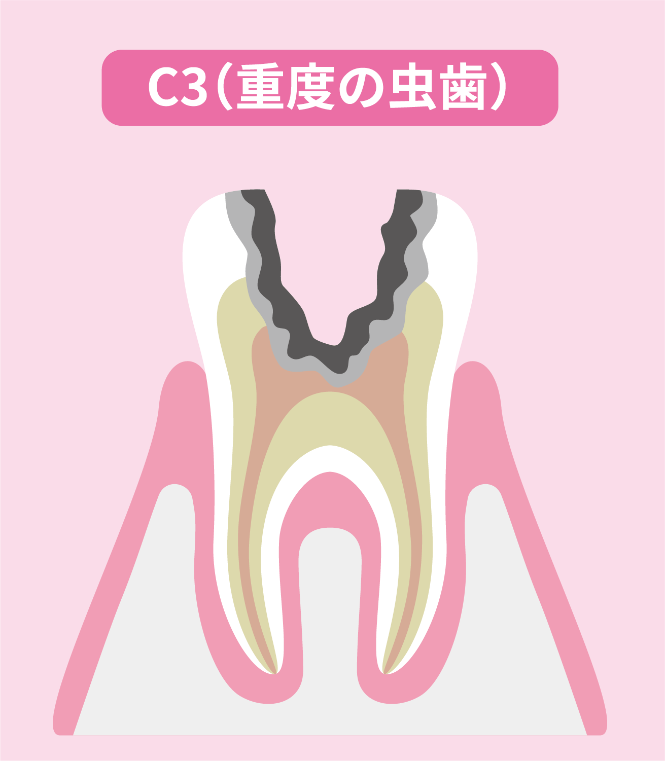 C3