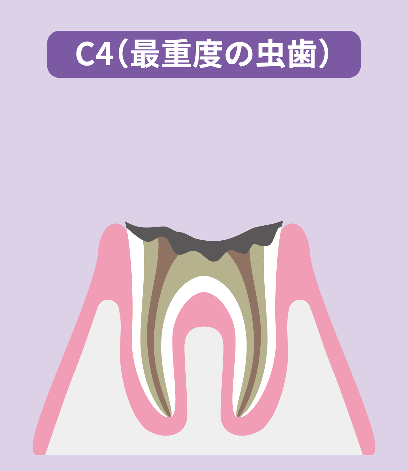 C4